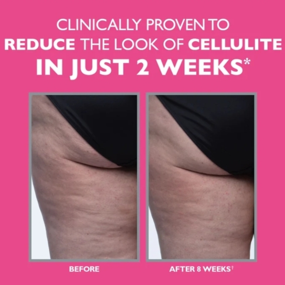 Peter Thomas Roth Tight & Toned Cellulite Treatment - Picture 5 of 10